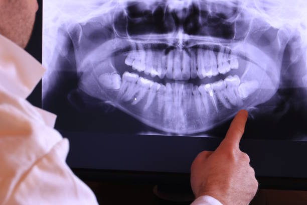 Best Emergency Denture Repair in Wilsons Mills, NC
