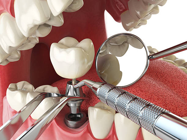 Best Emergency Treatment for Oral Infections in Wilsons Mills, NC